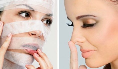 Качество Жизни: как устранить проблемы носа без пластической операции?