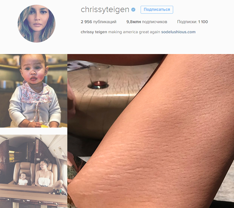 Крисси Тейген выложила в «Твиттер» снимок своих постродовых растяжек и в очередной раз выступила против ретуши фотографий